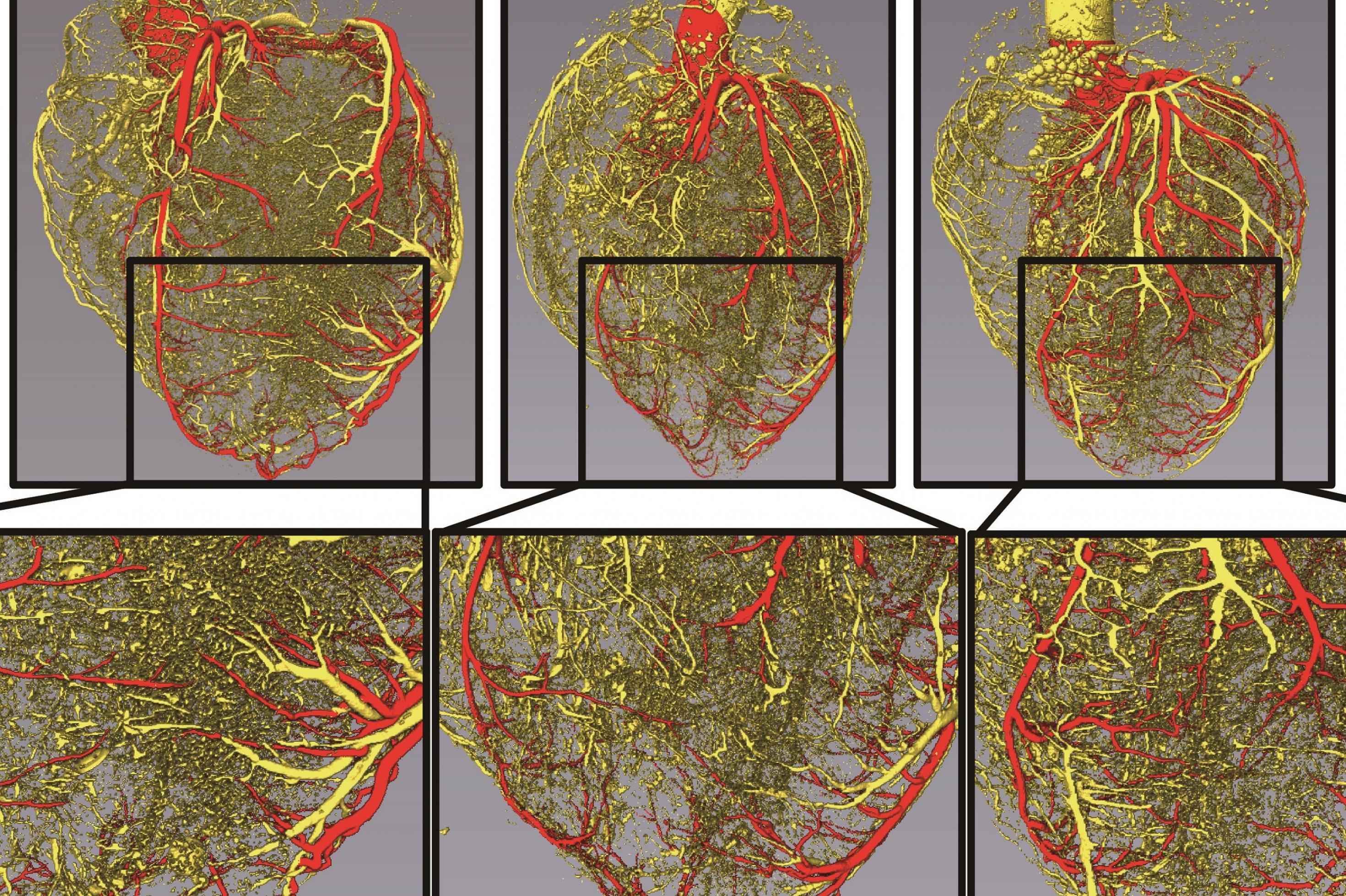 Aufnahmen der Herzkranzgefäße dreier Herzen. Das linke Herz hat mehr feine Blutgefäße als das mittlere und das rechte.