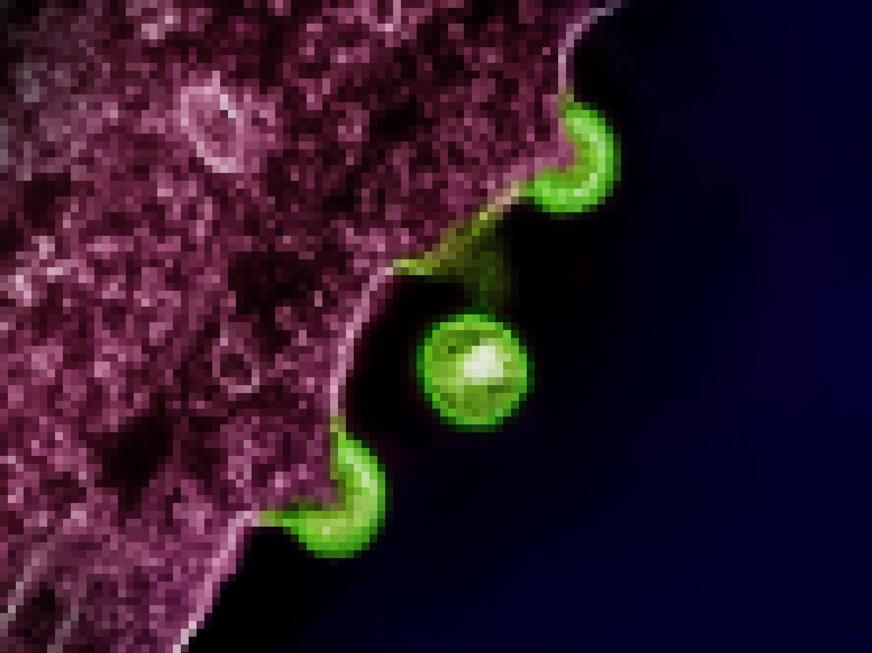 Elektronenmikroskopische Aufnahme von HIV-Partikeln (grün gefärbt), die von einer infizierten Zelle (violett) freigesetzt werden.