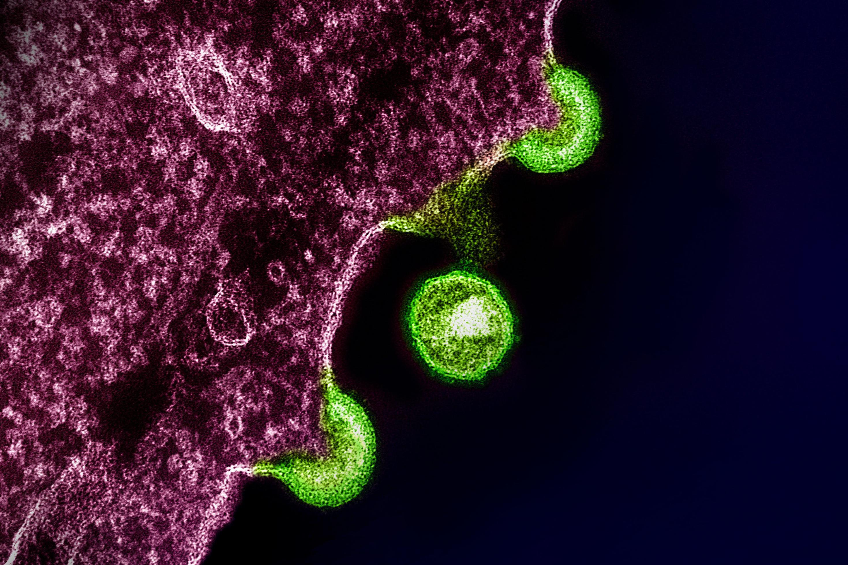 Elektronenmikroskopische Aufnahme von HIV-Partikeln (grün gefärbt), die von einer infizierten Zelle (violett) freigesetzt werden.