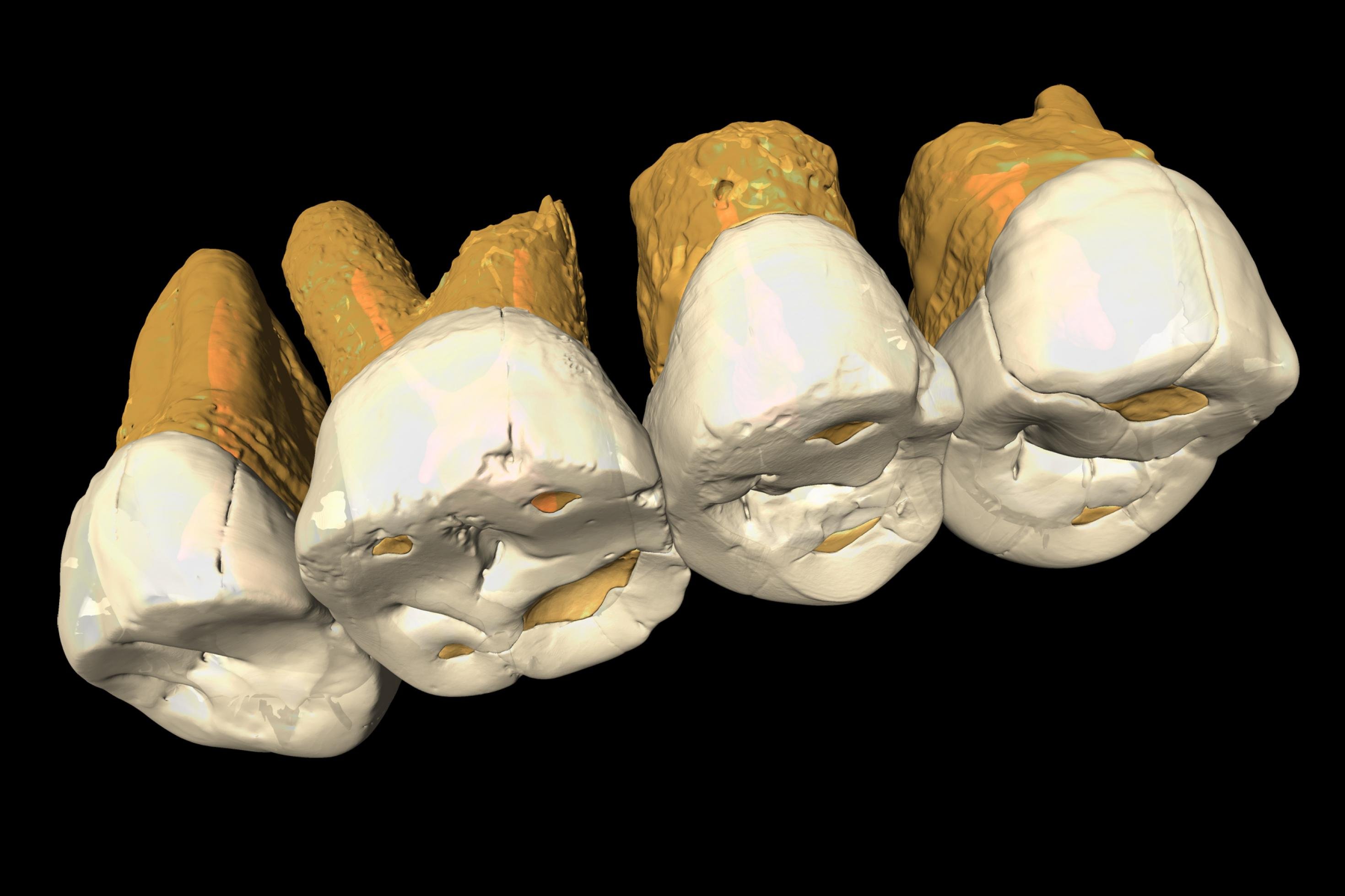 Auf dem Bild ist ein CT-Scan der Zähne von Homo luzonensis zu sehen. An der anatomischen Beschaffenheit der Zähne erkennen Paläoanthropologen eine Kombination von Merkmalen, wie sie bei keiner anderen Menschenart vorkommt