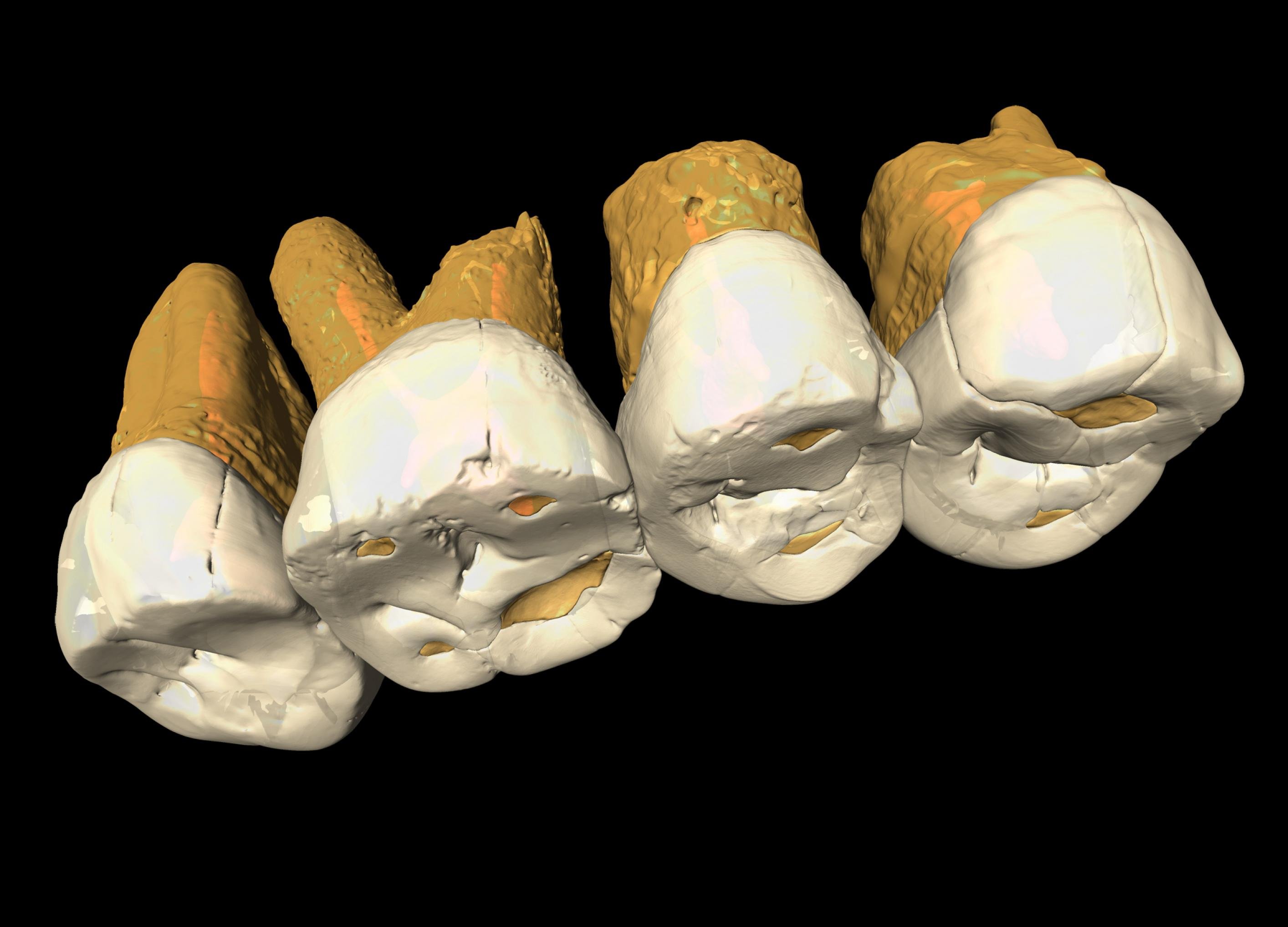 Auf dem Bild ist ein CT-Scan der Zähne von Homo luzonensis zu sehen. An der anatomischen Beschaffenheit der Zähne erkennen Paläoanthropologen eine Kombination von Merkmalen, wie sie bei keiner anderen Menschenart vorkommt