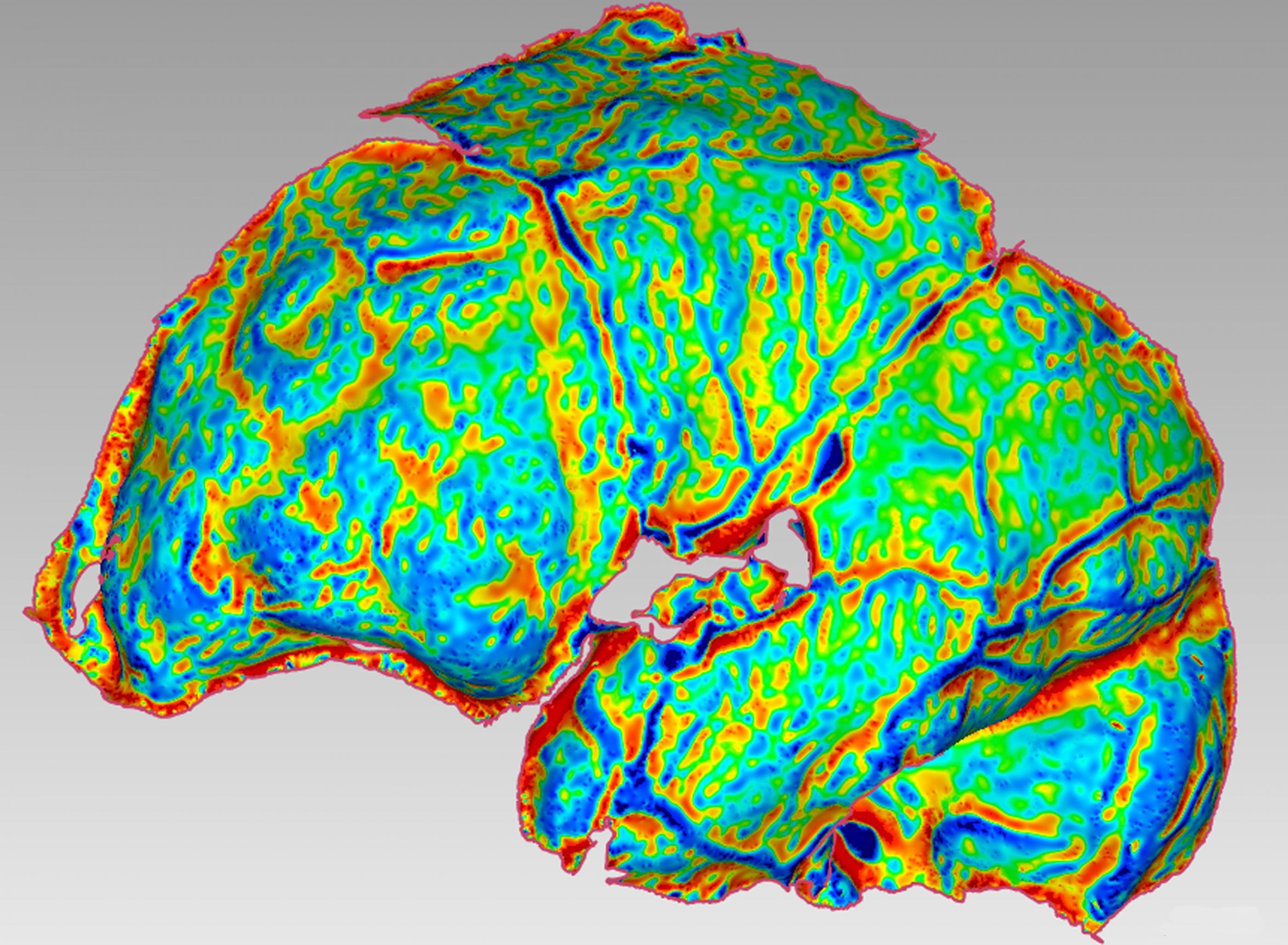 Das Bild zeigt die graphische Darstellung der Bögen und Wölbungen eines Gehirns. In überwiegend grünen, blauen und gelben Farben sind die verschiedenen Strukturen zu erkennen.