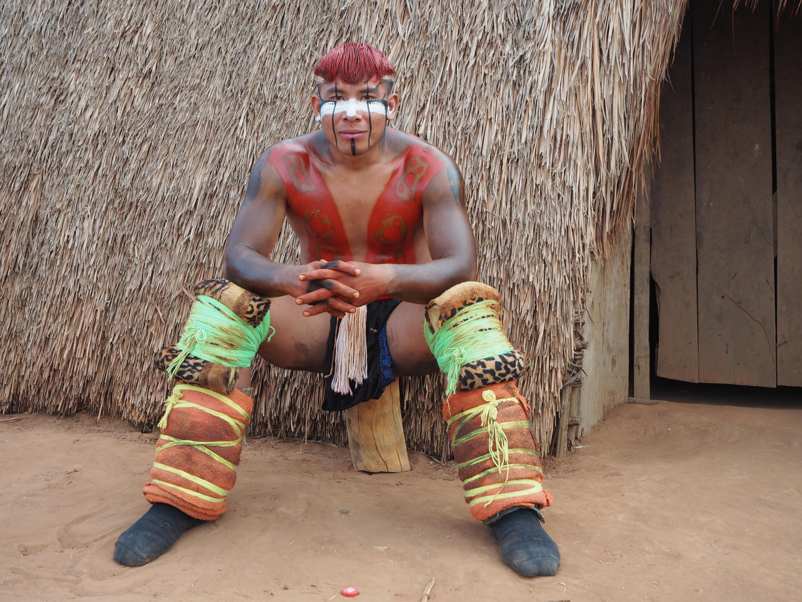 Ein junger Mann sitzt geschmückt vor seinem Haus. Seine Knie und Unterschenkel sind mit Baumwollbinden geschützt.