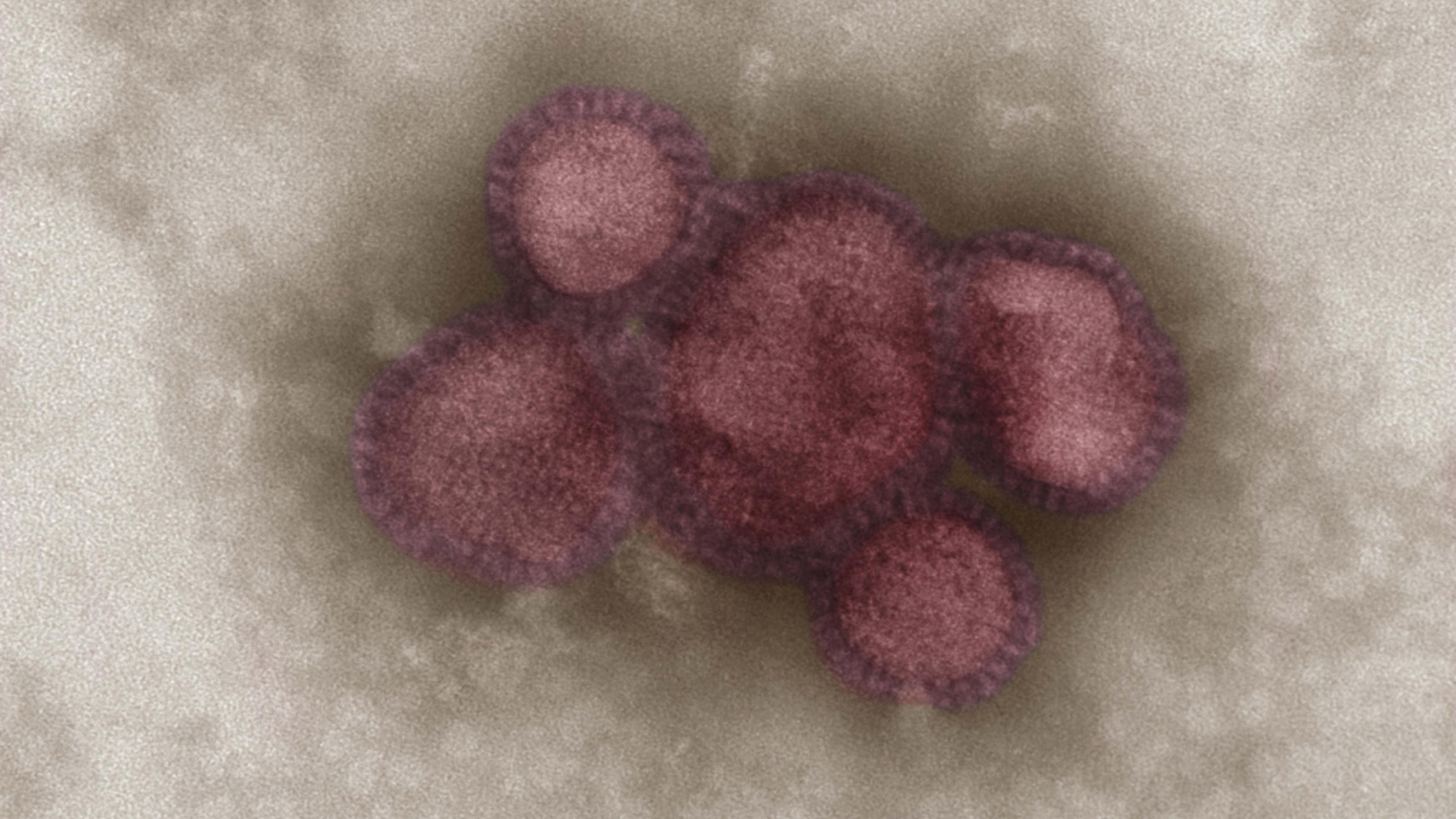 Hier wird eine Aufnahme des Grippevirus im Elektronenmikroskop am Robert Koch-Institut gezeigt. Jedes Jahr kommt der Erreger der Grippe, auch Influenza genannt, mit neuen Varianten und fordert das menschliche immer wieder heraus.