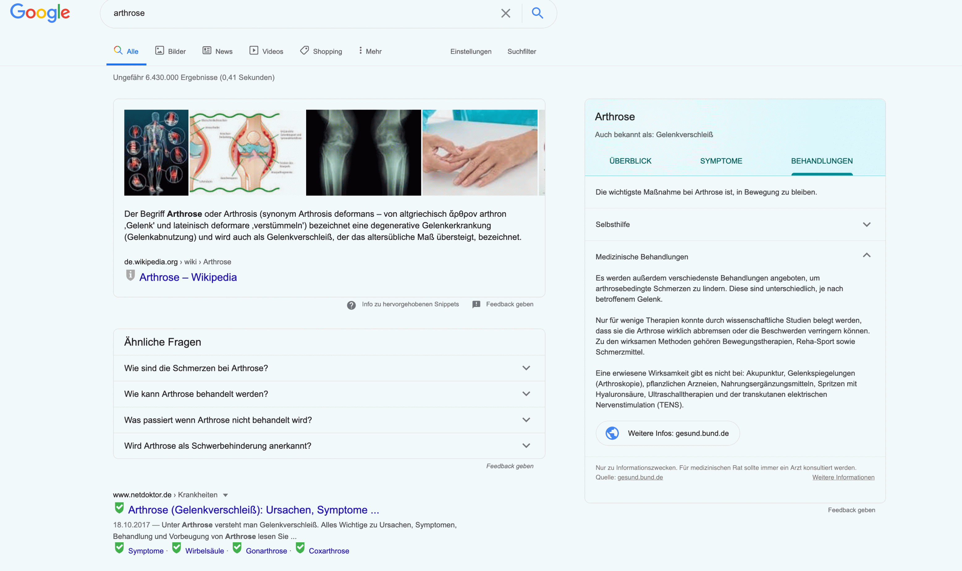 Ein Knowledge Panel wird oben rechts am Bildschirm angezeigt. Ein Screenshot zeigt das Knowledge Panel der Krankheit Arthrose