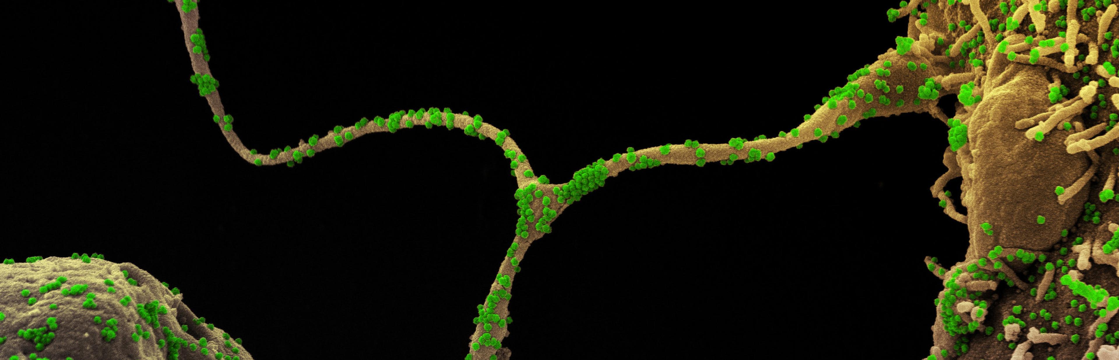 Das Foto zeigt eine elektronenmikroskopische Aufnahme von Coronaviren (grün) die Körperzellen (grau) infizieren.