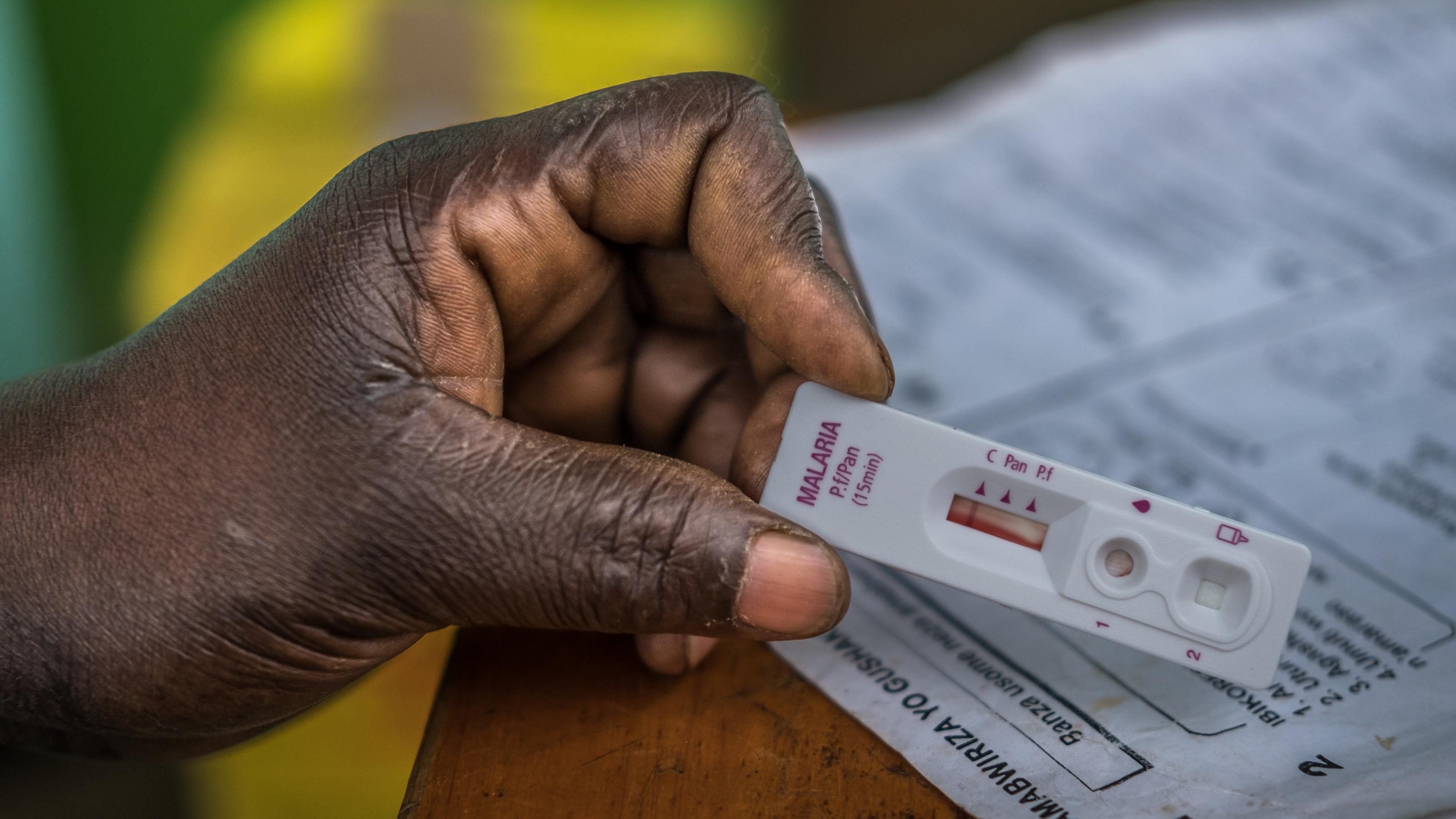 Eine Hand hält den Malaria-Schnelltest in die Kamera, darunter liegen Patientenakten