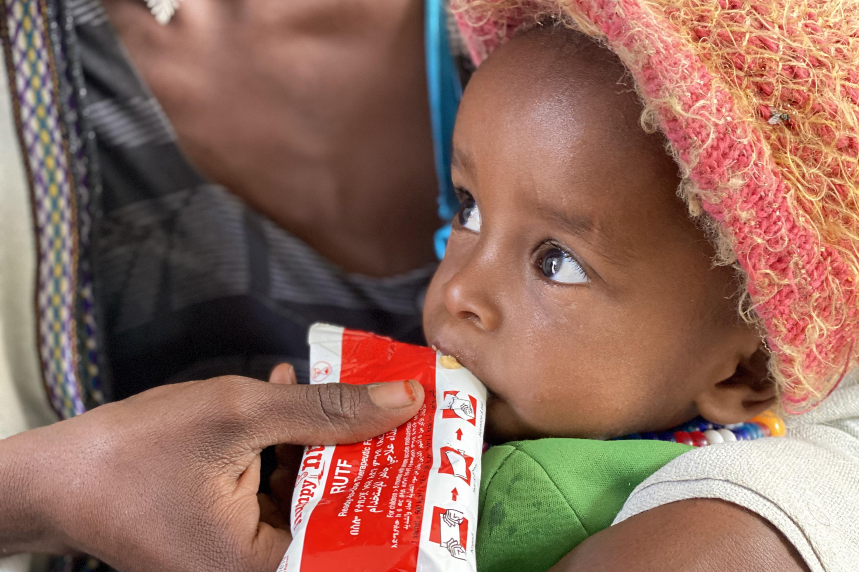 Amanuel Berhanu erhält auf dem Arm seiner Mutter therapeutische Zusatznahrung von UNICEF.