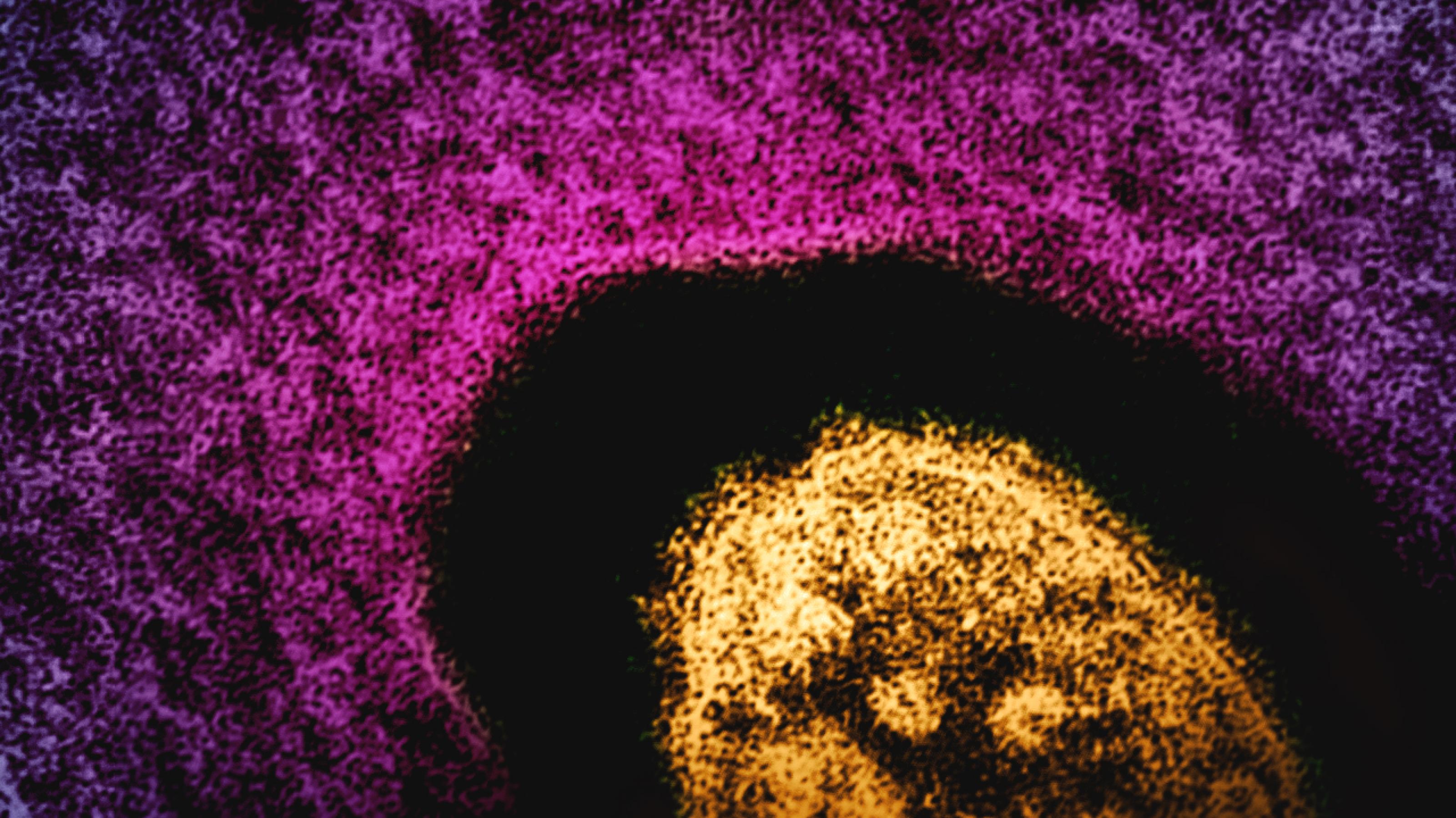 Elektronenmikroskopische Aufnahme eines Masern-Virus, hier gelb angefärbt.