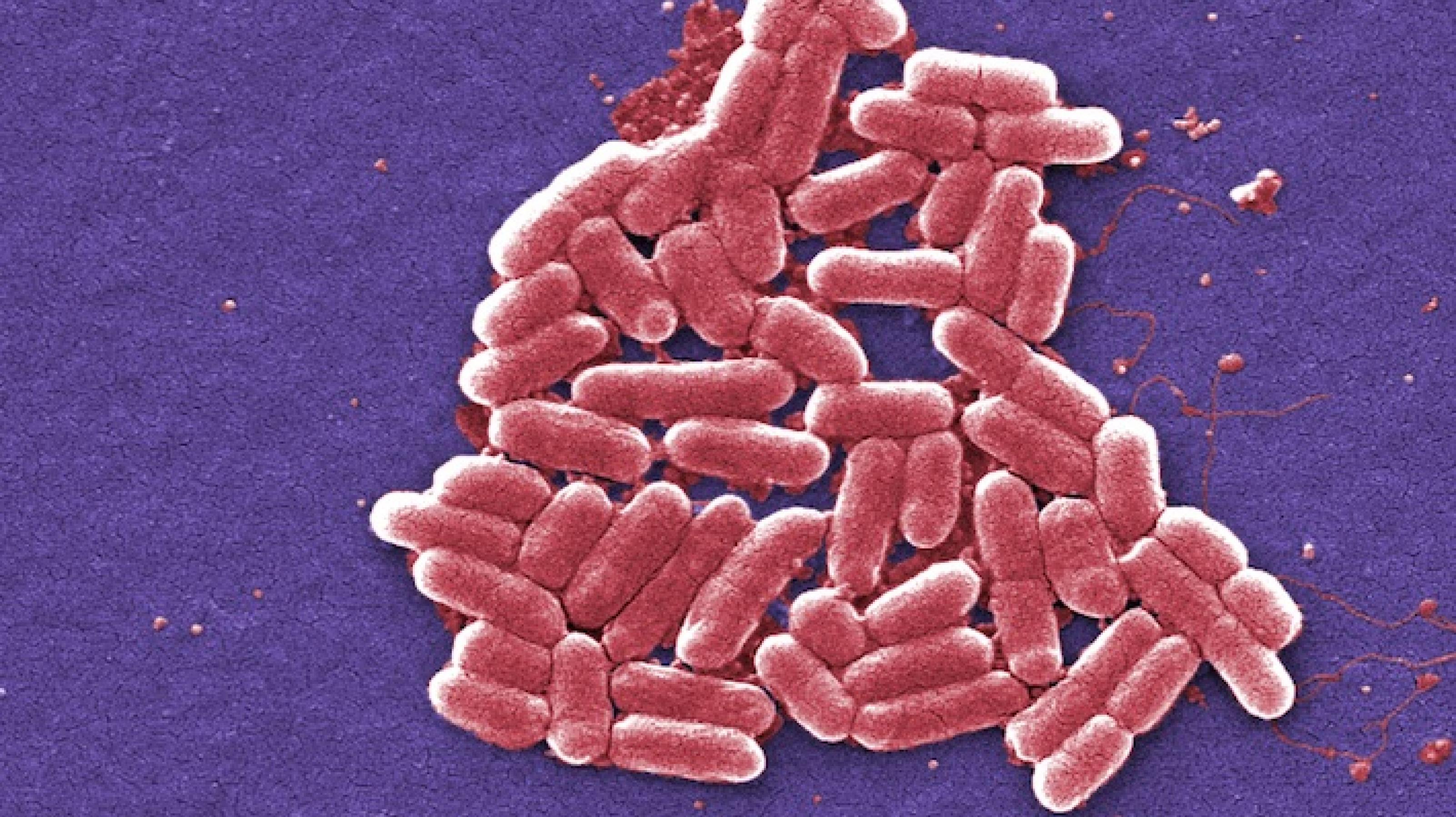 Stäbchenförmige Bakterien, rosa angefärbt, unter dem Mikroskop
