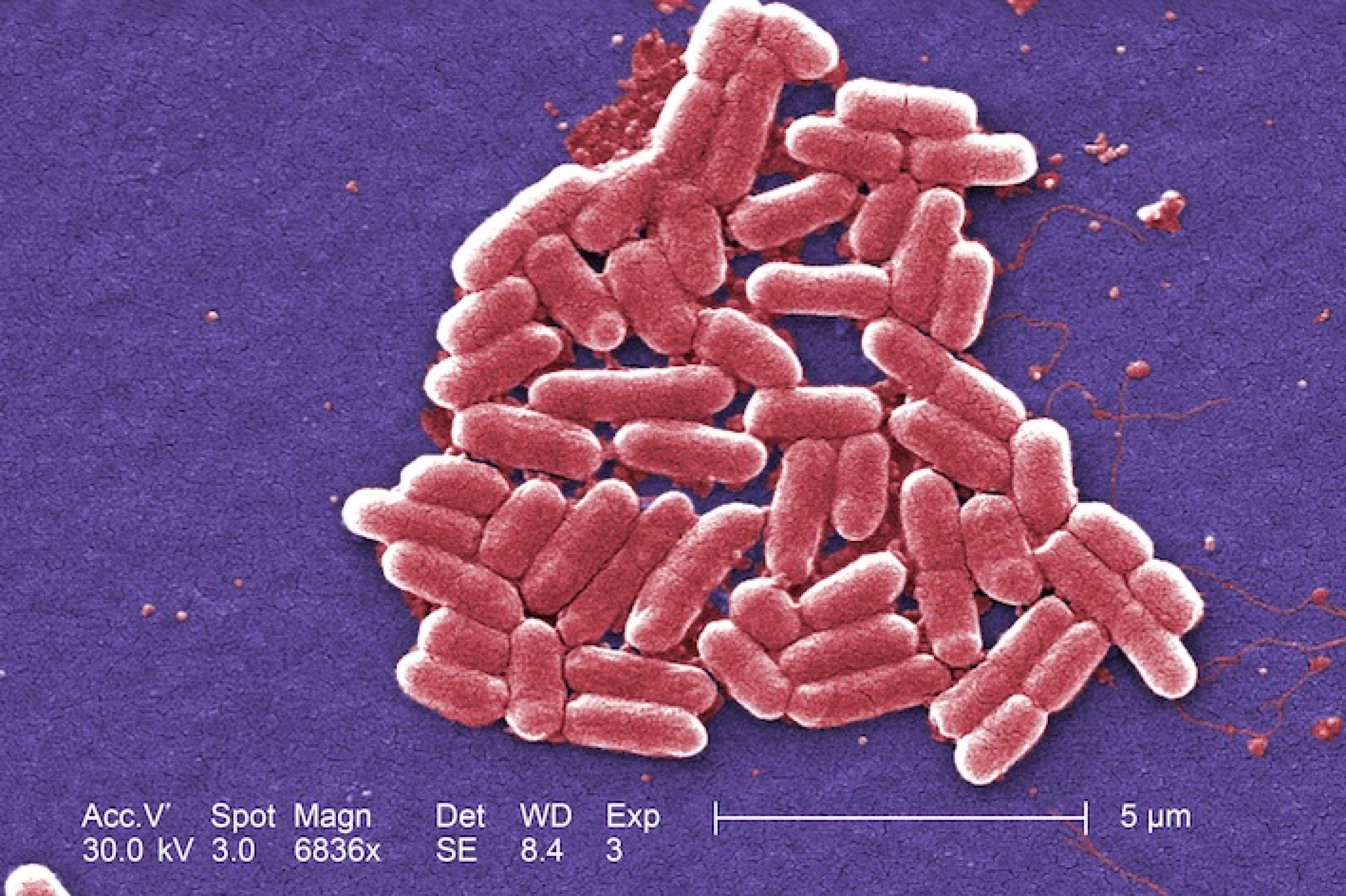 Stäbchenförmige Bakterien, rosa angefärbt, unter dem Mikroskop