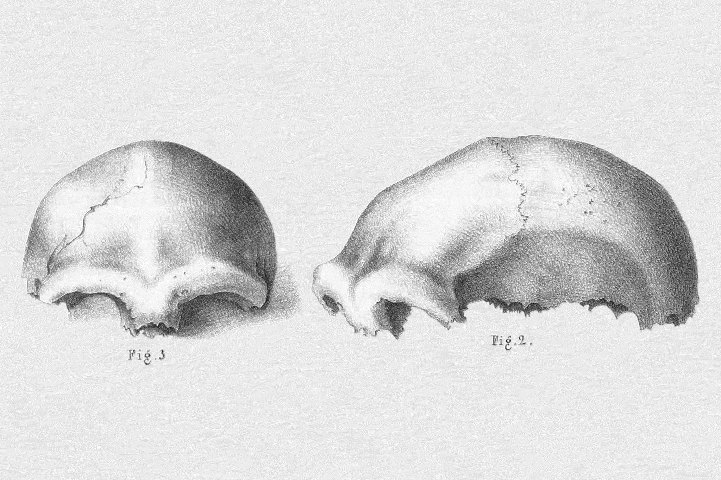 Zu sehen sind zwei historische Schwarzweiß-Zeichnungen vom oberen Teil eines Schädels. Links ist die Ansicht von vorne zu sehen, rechts die Ansicht von der Seite. Auffällig sind die sehr stark ausgeprägten Knochenwülste über den Augenhöhlen.