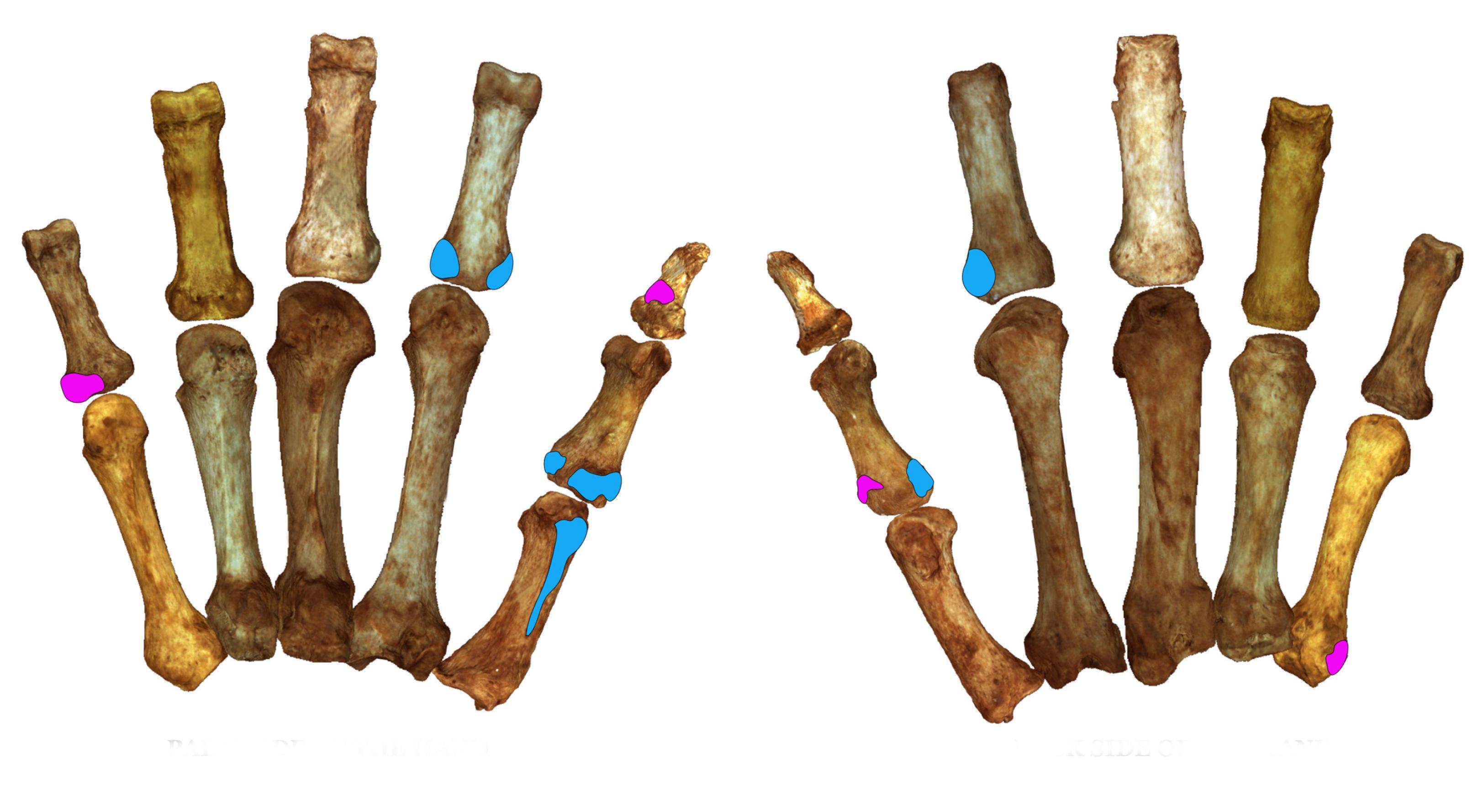 Das Bild zeigt die Handknochen eines Neandertalers. Daran sind jene Stellen farbig markiert, an denen Muskeln ansetzen, mit welchen die Urmenschen Kraft- und Präzisionsgriffe ausübten. Forscher konnten so nachweisen, dass Neandertaler ebenso feinfühlig greifen können wie moderne Menschen.