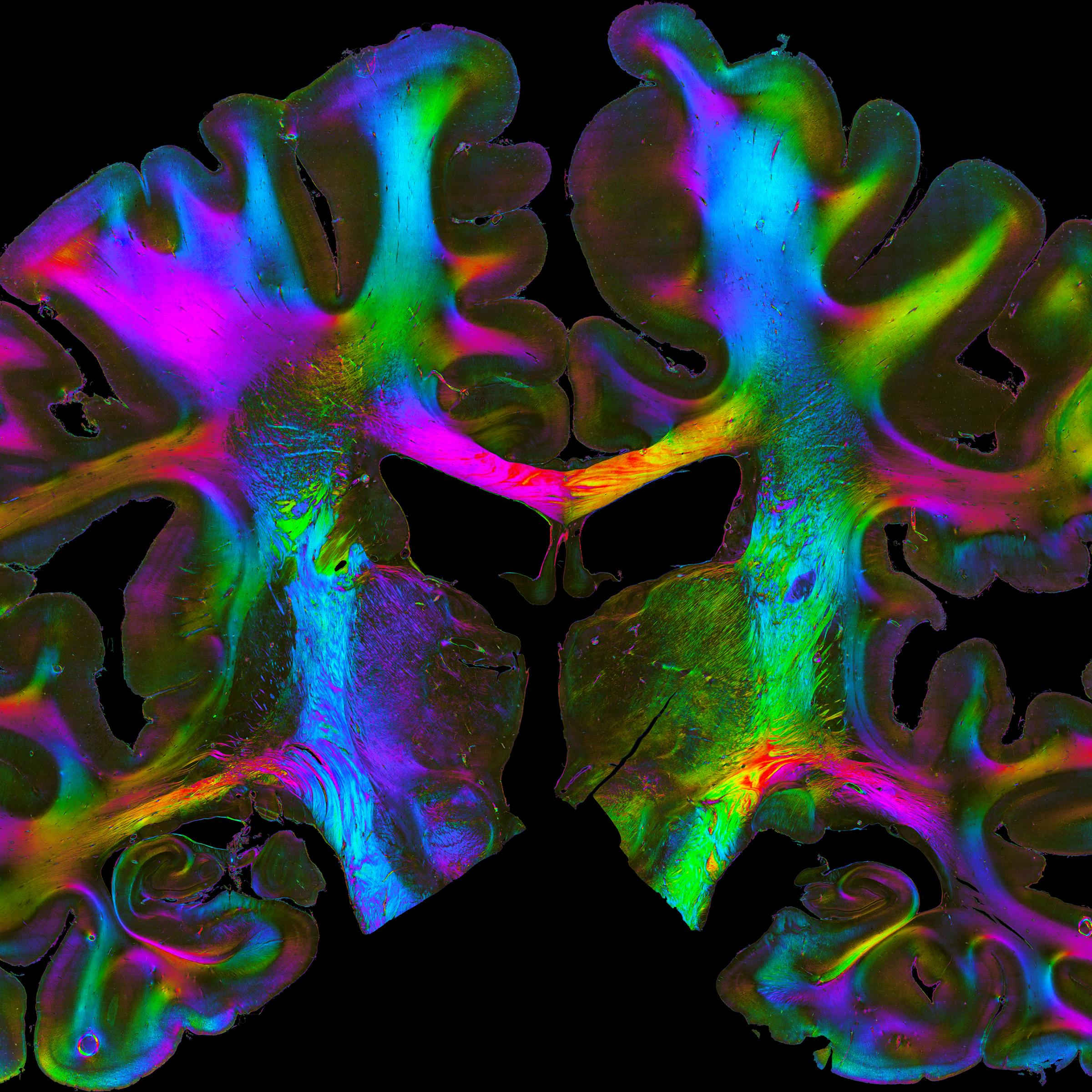 Nervenfasern eines menschlichen Gehirns, dargestellt mittels „Polarized Light Imaging“. Die Methode, entwickelt am Forschungszentrum Jülich, macht die Verläufe von Nervenfasern mit einer Auflösung von wenigen tausendstel Millimetern sichtbar.