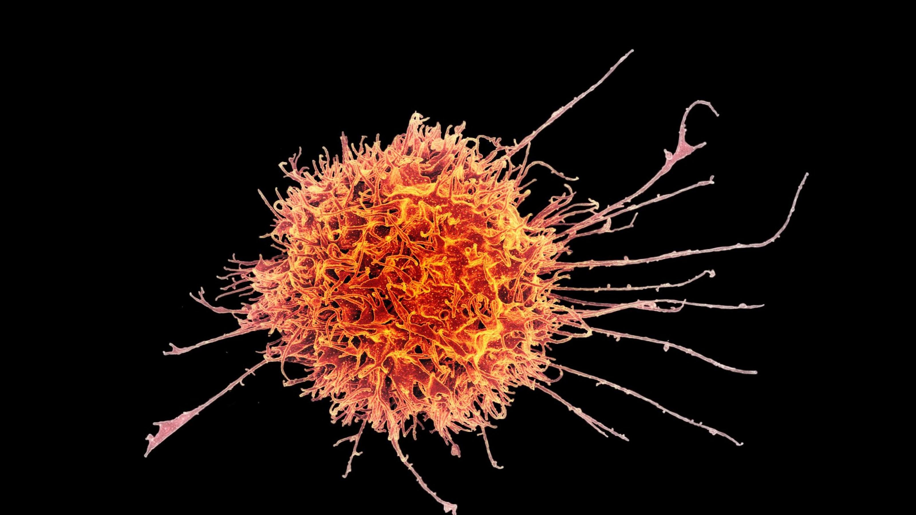 Eine orange angefärbte Immunzelle, stark vergrößert mit Hilfe der Elektronenmikroskopie.
