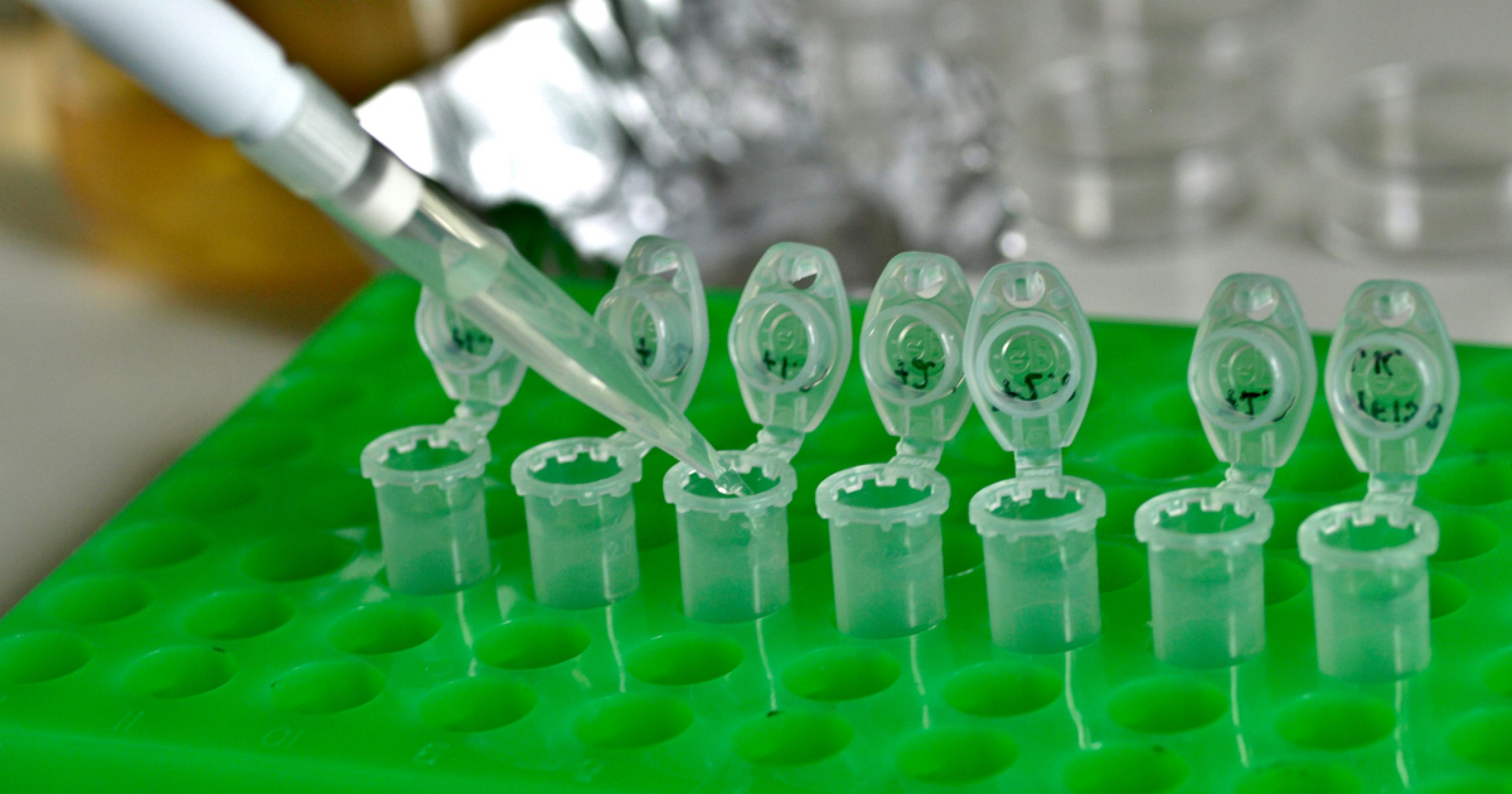 Aus einer Labor-Pipette wird klare Flüssigkeit in Reaktionsgefäße mit Schnappdeckel überführt.