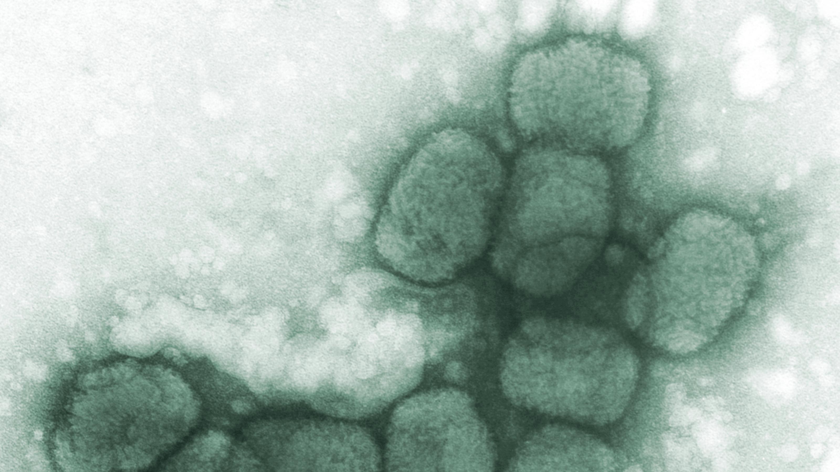 Ein Blick in ein Elektronenmikroskop zeigt einige oval wirkende Pockenviren.