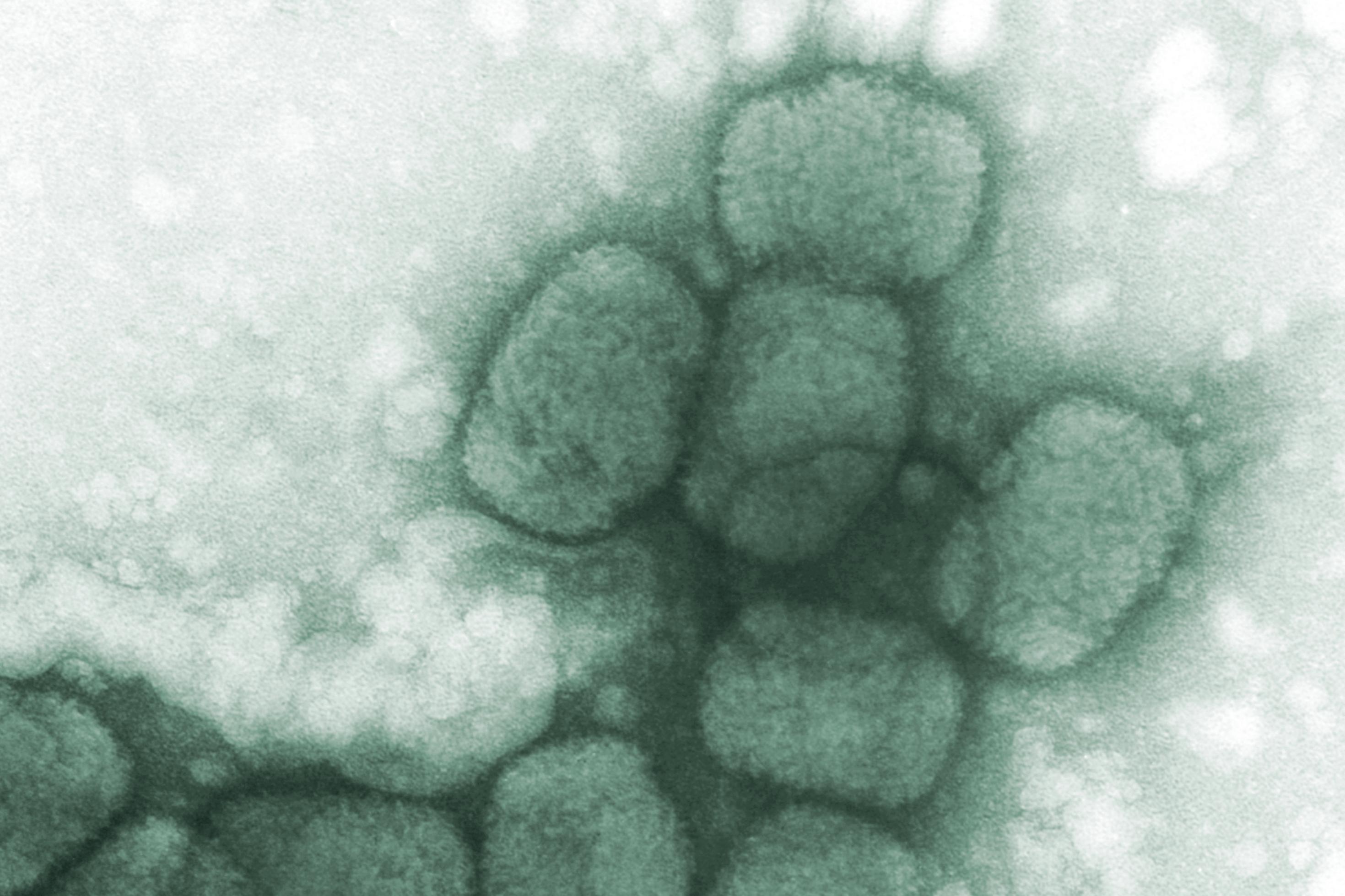 Ein Blick in ein Elektronenmikroskop zeigt einige oval wirkende Pockenviren.