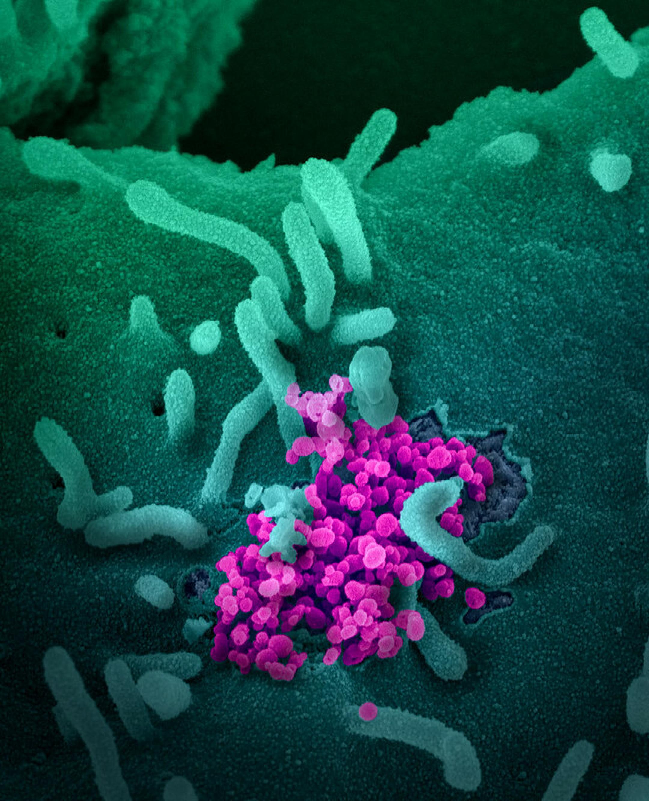Elektronenmikroskopische Aufnahme von Sars-CoV-2, dem Erreger von Covid-19. Die Viruspartikel sind violett, die infizierten Zellen grün angefärbt.