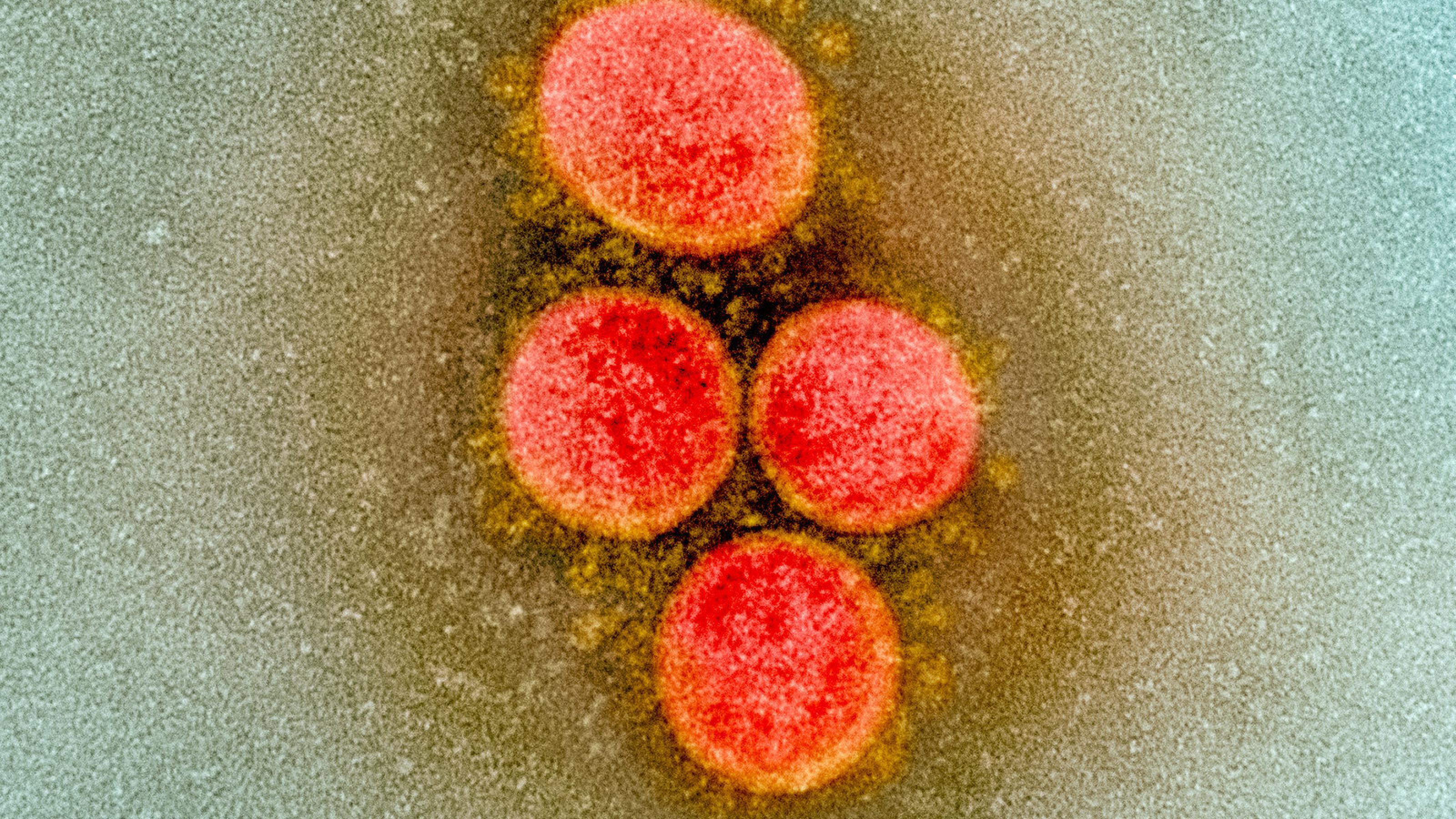 Das Bild zeigt eine elektronenmikroskopische Aufnahme des Sars-CoV-2, die Viren sind rot angefärbt