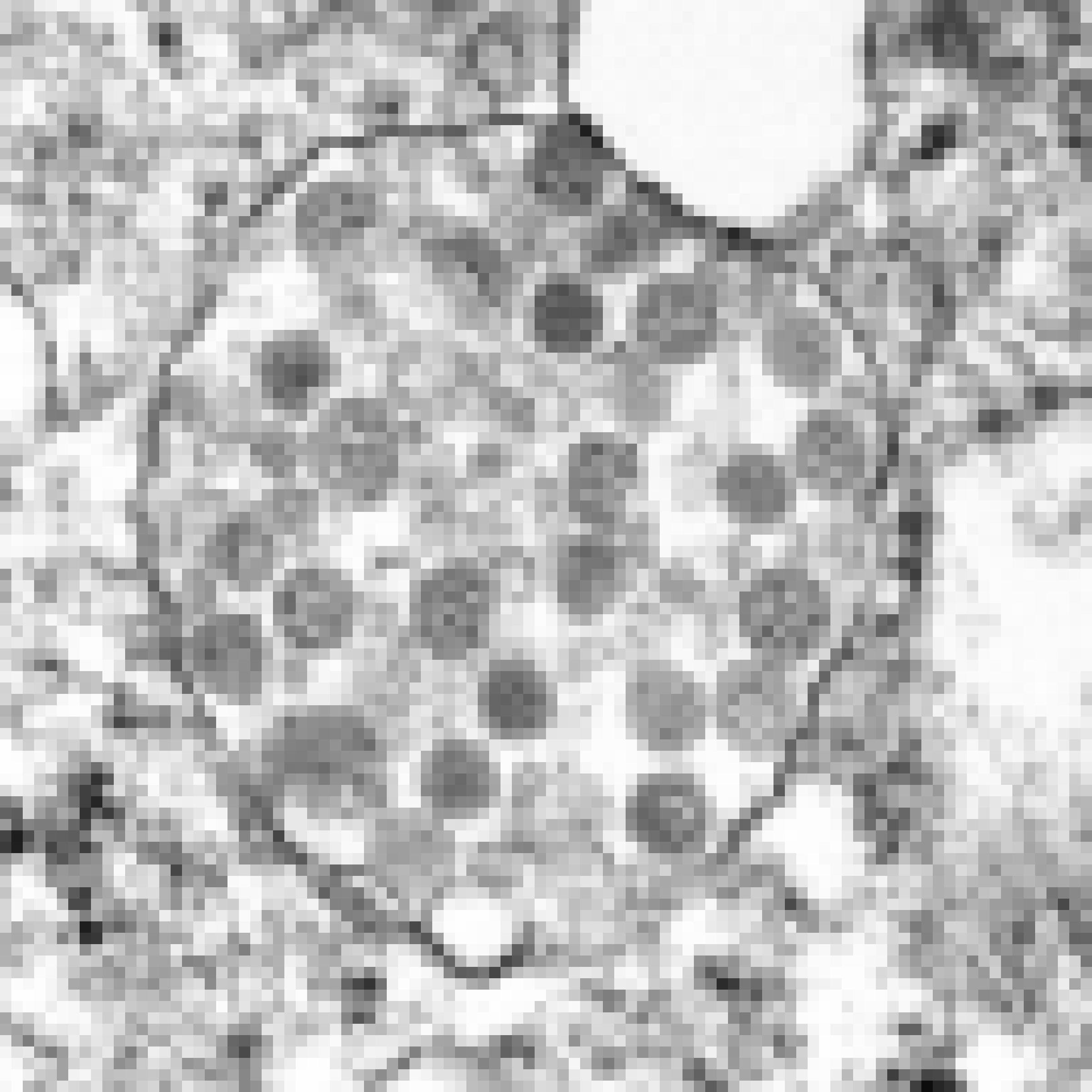 Elektronenmikroskopische Aufnahme einer mit Sars-CoV-2 infizierten Körperzelle. Zu erkennen sind die sphärischen Viruspartikel, die von der Zelle produziert worden sind.