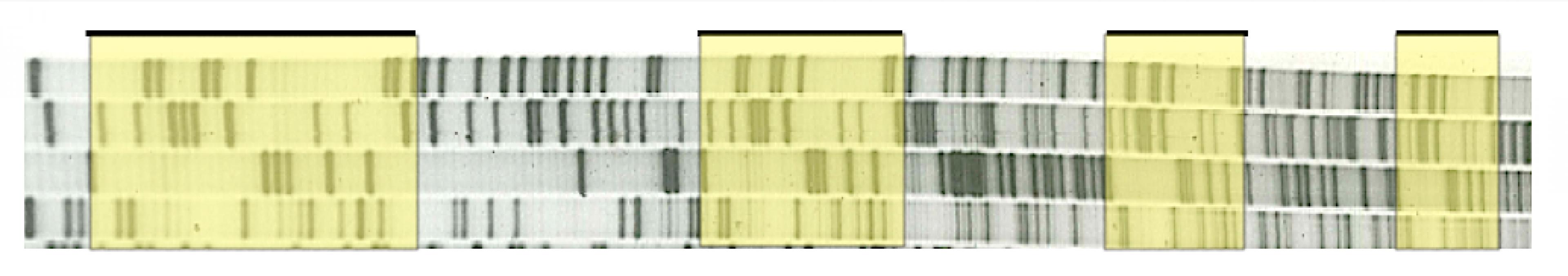 Bandenmuster der CRISPR-Sequenzen, die Francisco Mojica in seinen Archaebakterien entdeckt hat.