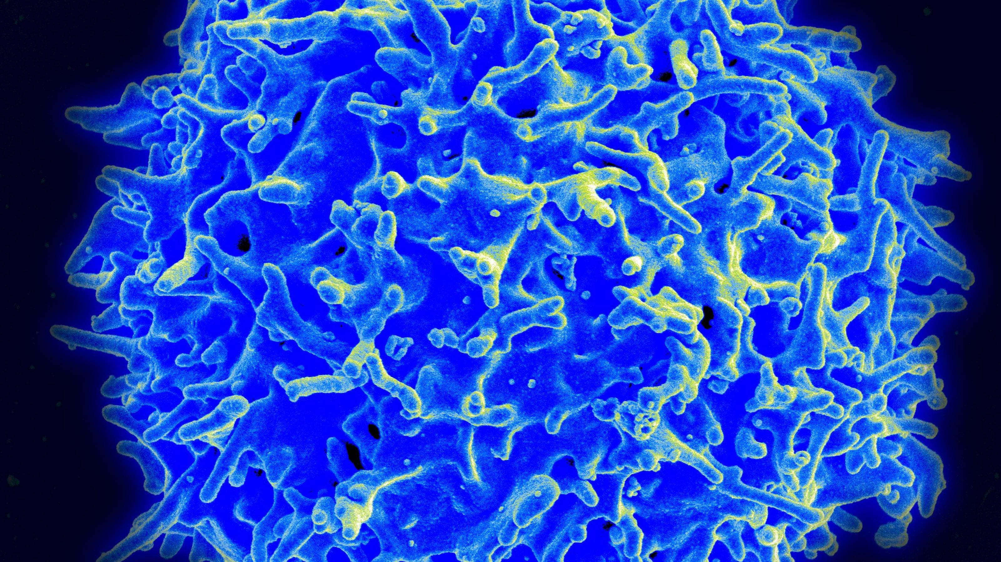 Das Bild zeigt eine mikroskopische Aufnahmen einer T-Zelle, blau angefärbt.