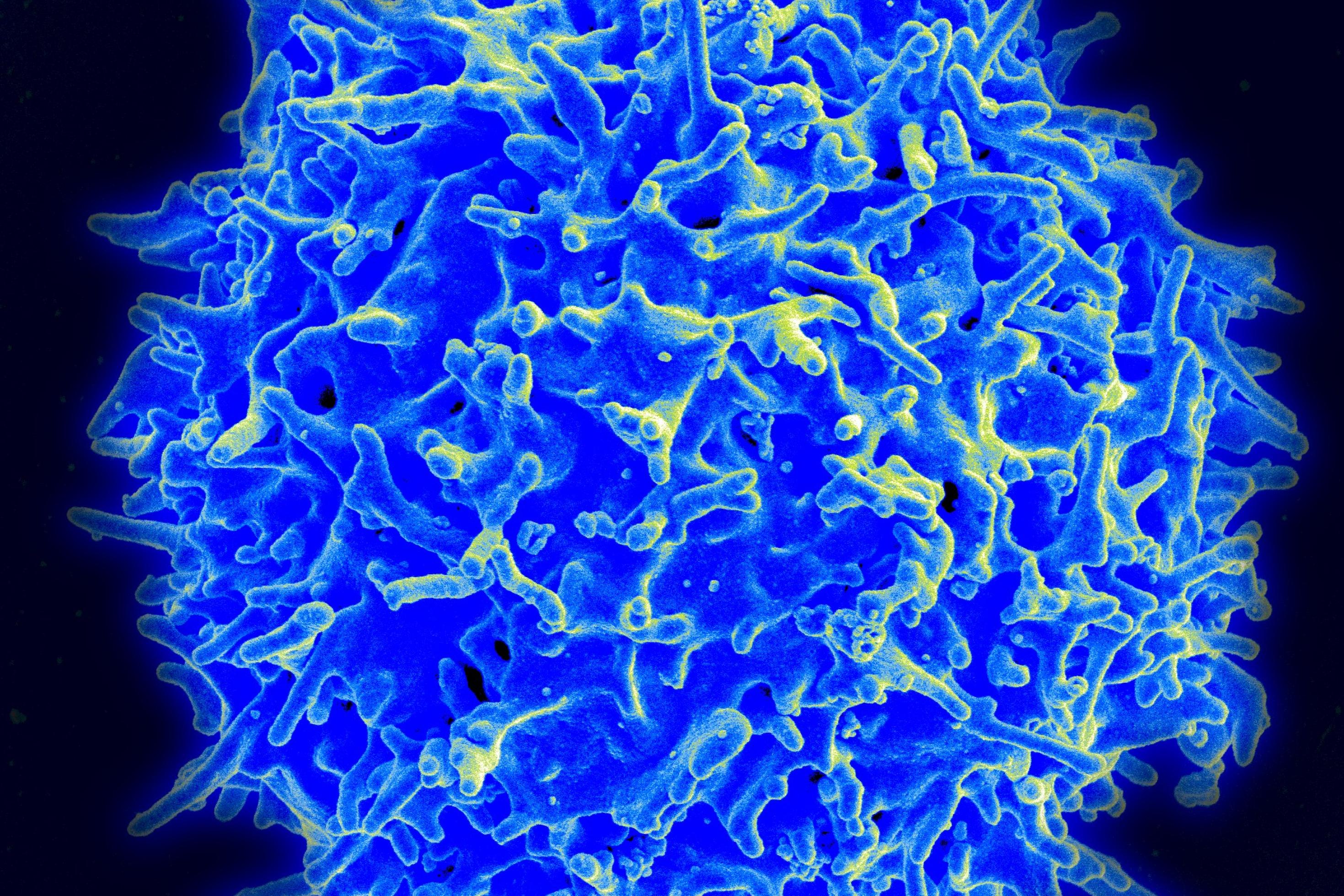 Das Bild zeigt eine mikroskopische Aufnahmen einer T-Zelle, blau angefärbt.