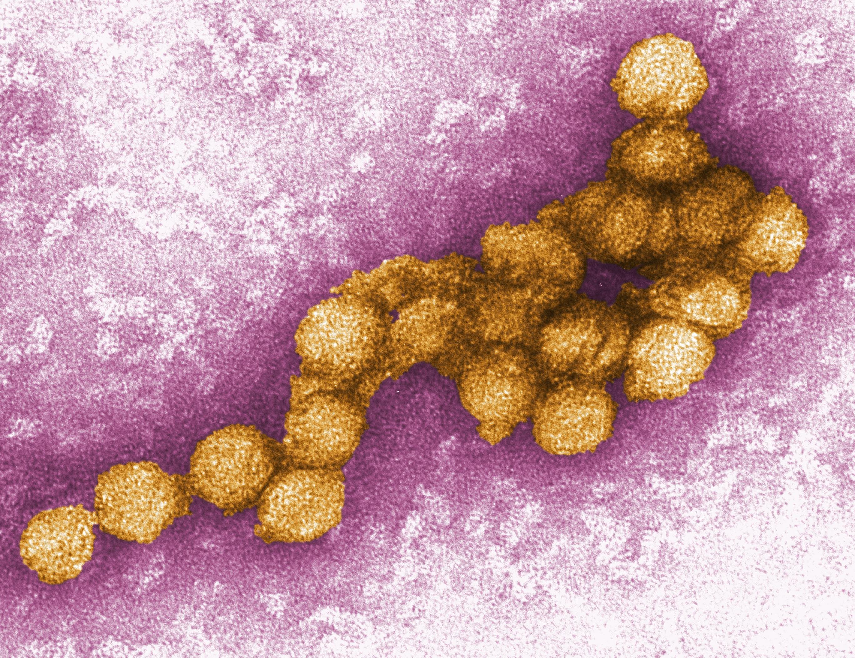 Foto zeit eine elekotronenmikroskopische Aufnahme eines West-Nil-Virus.