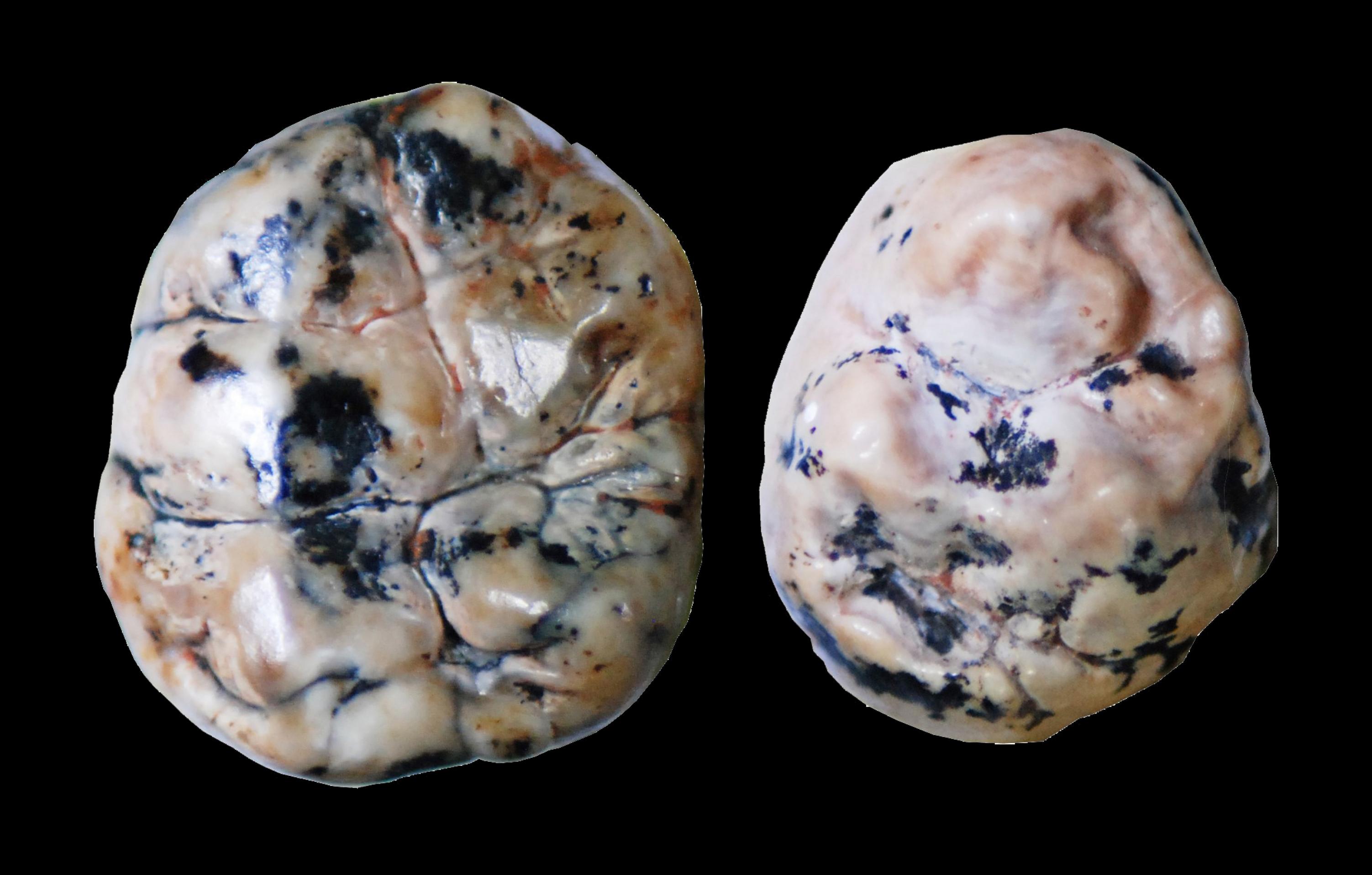 Das Foto zeigt links den fossilen Zahn eines Australopithecus africanus von oben und rechts den etwas kleineren Zahn eines frühen Homo. Paläoanthropologen können die Zähne anhand ihrer unterschiedlichen Morphologie – etwa die Form der Hügel und Furchen auf der Zahnkrone – zuordnen. Doch nicht nur das: Forscher um den Franzosen Vincent Balter von der Universität Lyon analysierten auch das Verhältnis von Variationen (Isotopen) des Elementes Kalzium in den Zähnen und konnten nachweisen, dass sich die Arten in ihrem Stillverhalten unterscheiden.