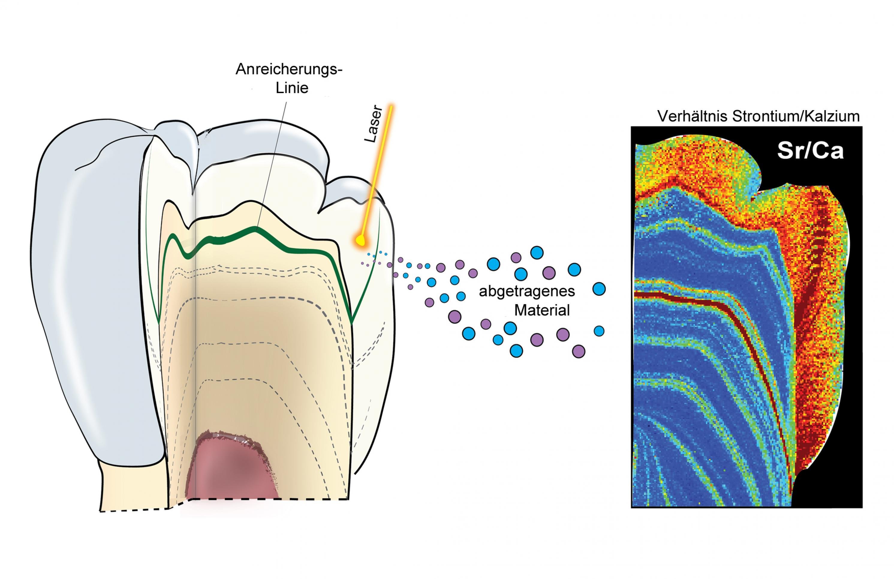 Die Illustration zeigt links einen aufgeschnittenen Zahn, dessen Inneres einen schichtweisen Aufbau erkennen lässt. Während der Zahn im Kiefer eines Kindes wächst, werden solche Schichten abgelagert – und je nach Ernährung reichern sich bestimmte Spurenelemente an. Zudem ist ein eingezeichneter Laserstrahl zu sehen, der vom Zahn winzige Mengen an Materials herauslöst, das die Forscher analysieren. Ganz rechts ist das Schnittbild eines Zahns zu erkennen, in dem das Verhältnis des Spurenelements Strontium zum Hauptelement Kalzium farbig dargestellt. Aus diesem Verhältnis können Forscher schließen, zu welchem Zeitpunkt während der Zahnentstehung ein Kind Muttermilch erhalten hat.